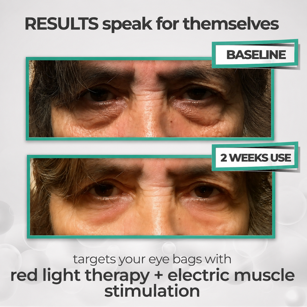 Relvani-Eyes® 2-in-1 Red Light Therapy + EMS To Erase Eye Bags